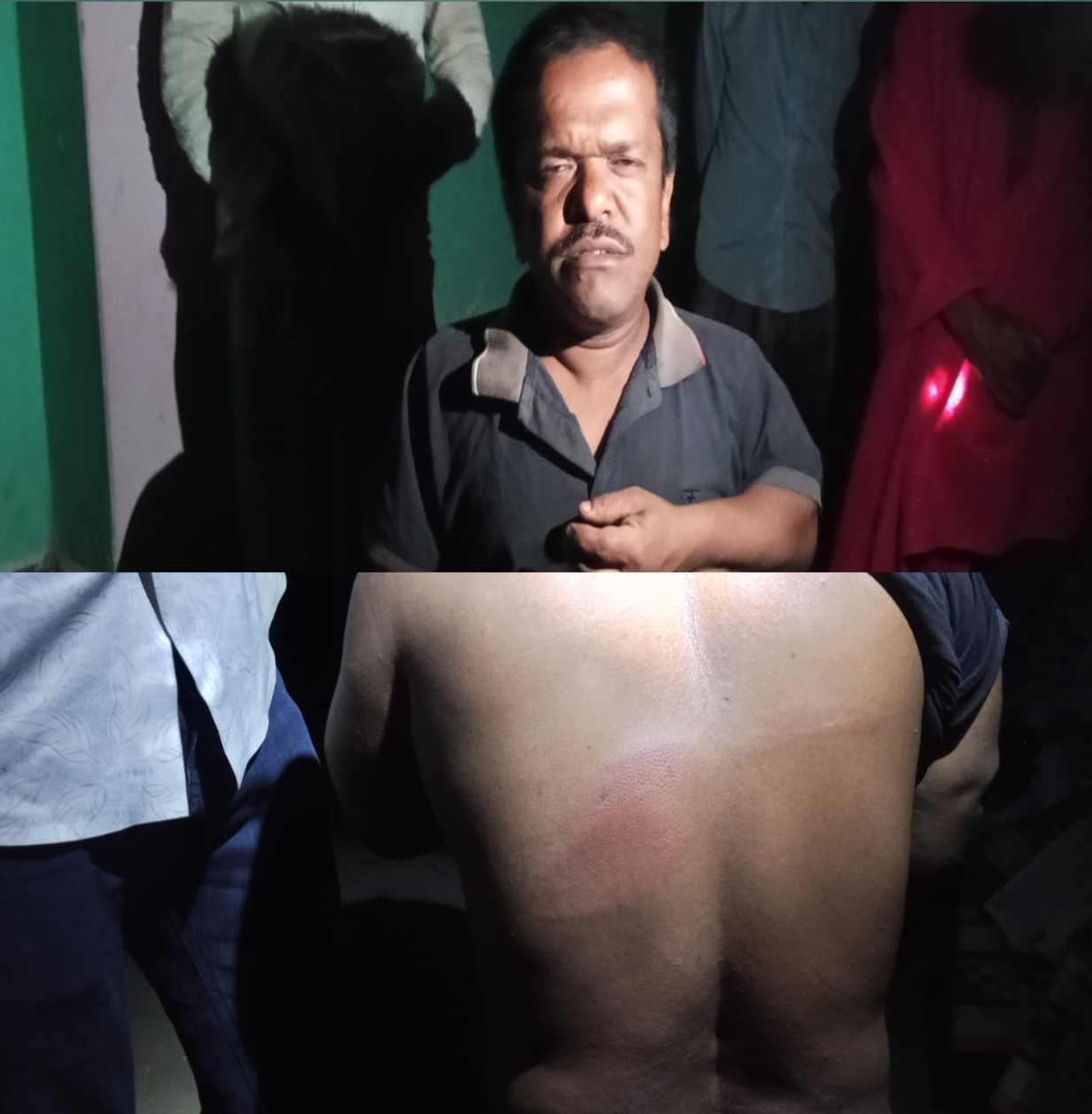 মিরপুরে প্রতিবন্ধী টোটনের উপর হামলা, গুরুতর জখম